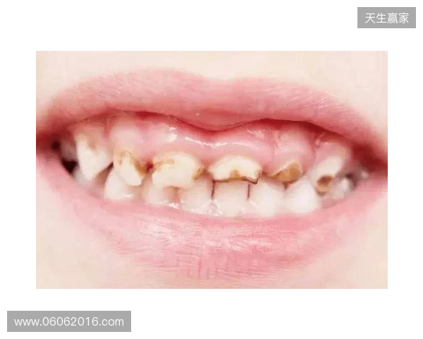 韦林顿确诊上唇部贯通伤;11、21牙半脱位;上颌前牙区牙槽骨骨折 韦林顿确诊上唇部贯通伤;11、21牙半脱位;上颌前牙区牙槽骨骨折